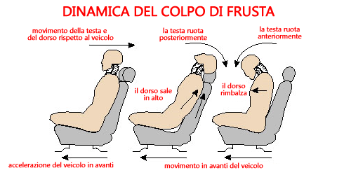 dinamica-del-colpo-di-frusta